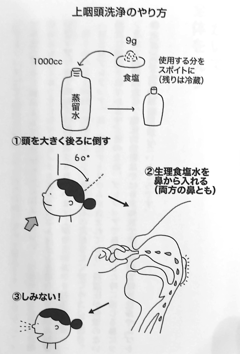 図2 上咽頭洗浄のやり方 慢性上咽頭炎を治しなさい 第2章